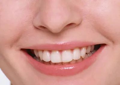 Dentinhos e Dentes