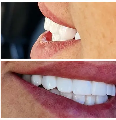 Premium Smile