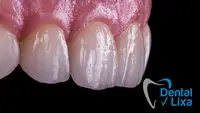 DentalLixa