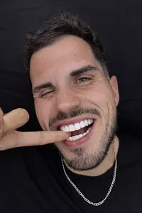 Facetas em Resina - Dr. Thiago Fonseca