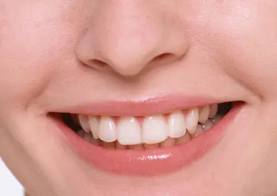 Dentinhos e Dentes