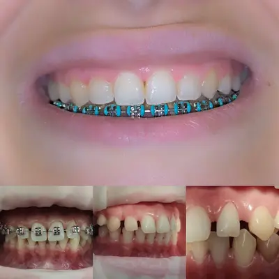 Clínica Dentária LongoDente Esmoriz