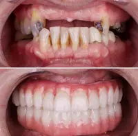 Clínica Dentária Dentbom Capelas