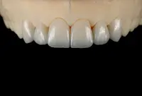 Clínica Dentária Dentbom - Vila Franca do Campo